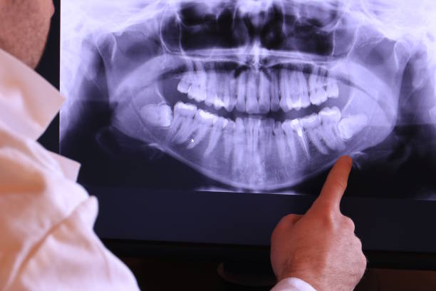 Best Weekend Emergency Dentist in Pana, IL